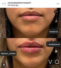 Load image into Gallery viewer, LipSmart® Powerful Hydration for Dry Lips

